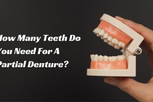 How Many Teeth Do You Need For a Partial Denture?